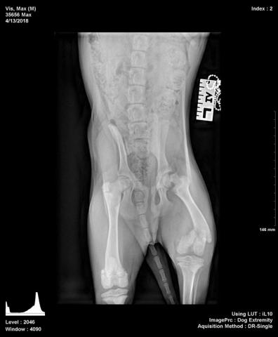 Notice the difference between the left side and the right. This is pre surgery. 